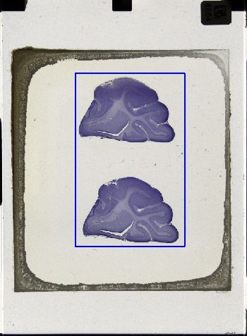 Media type: image; Special Collections 3043   shows specimen_part histological serial section;